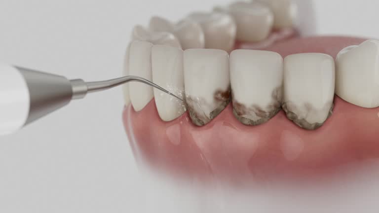 Trusted Invisalign Clear Aligners service in Slaughterville, OK - Dentist Open Now